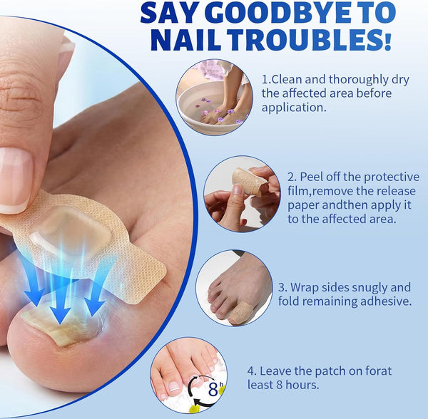 NailRevive™ – Tratament Intens pentru Unghii Deteriorate și Îngălbenite